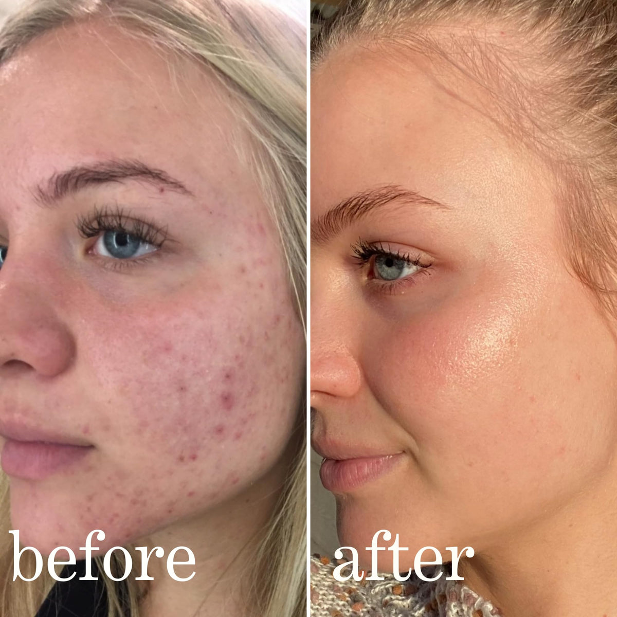 Lissy Mandelic Acid Serum Toner bottle close view for easy daily use
