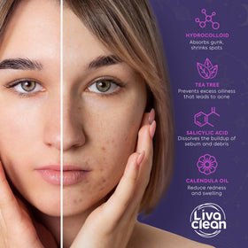 LivaClean bundle is cruelty-free and non-drying for gentle acne care.