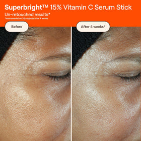 Close-up of texture showing brightening action and uneven tone target