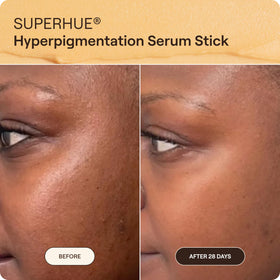 Close-up of Live Tinted Superhue vitamin C enhancement on skin