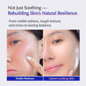 Livreome probiotic exosome bottle hints at gentle ecosystem balance for reactive skin.