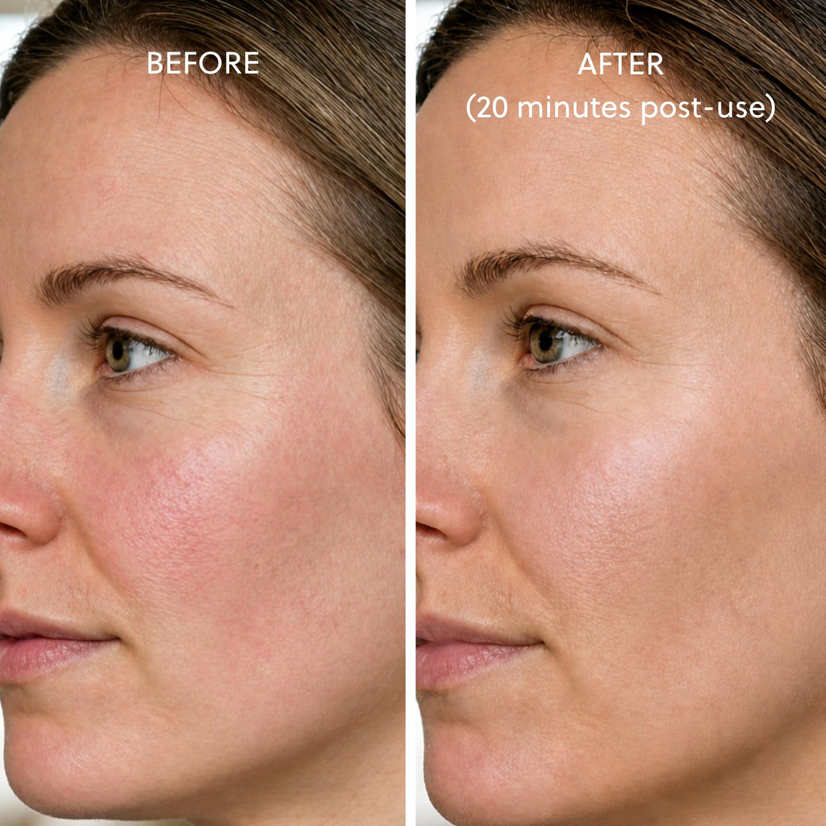 LOA SKIN stainless steel roller delivers cooling and texture refinement.