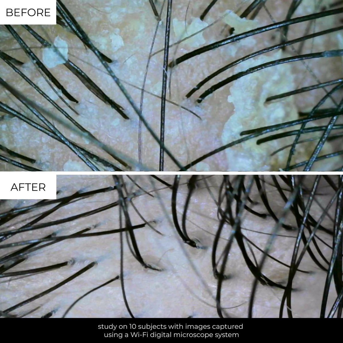 Lolavie precision nozzle image shows targeted root application for effective detox.