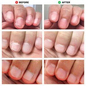 LONDONTOWN No Bite being applied on a child’s nails under supervision