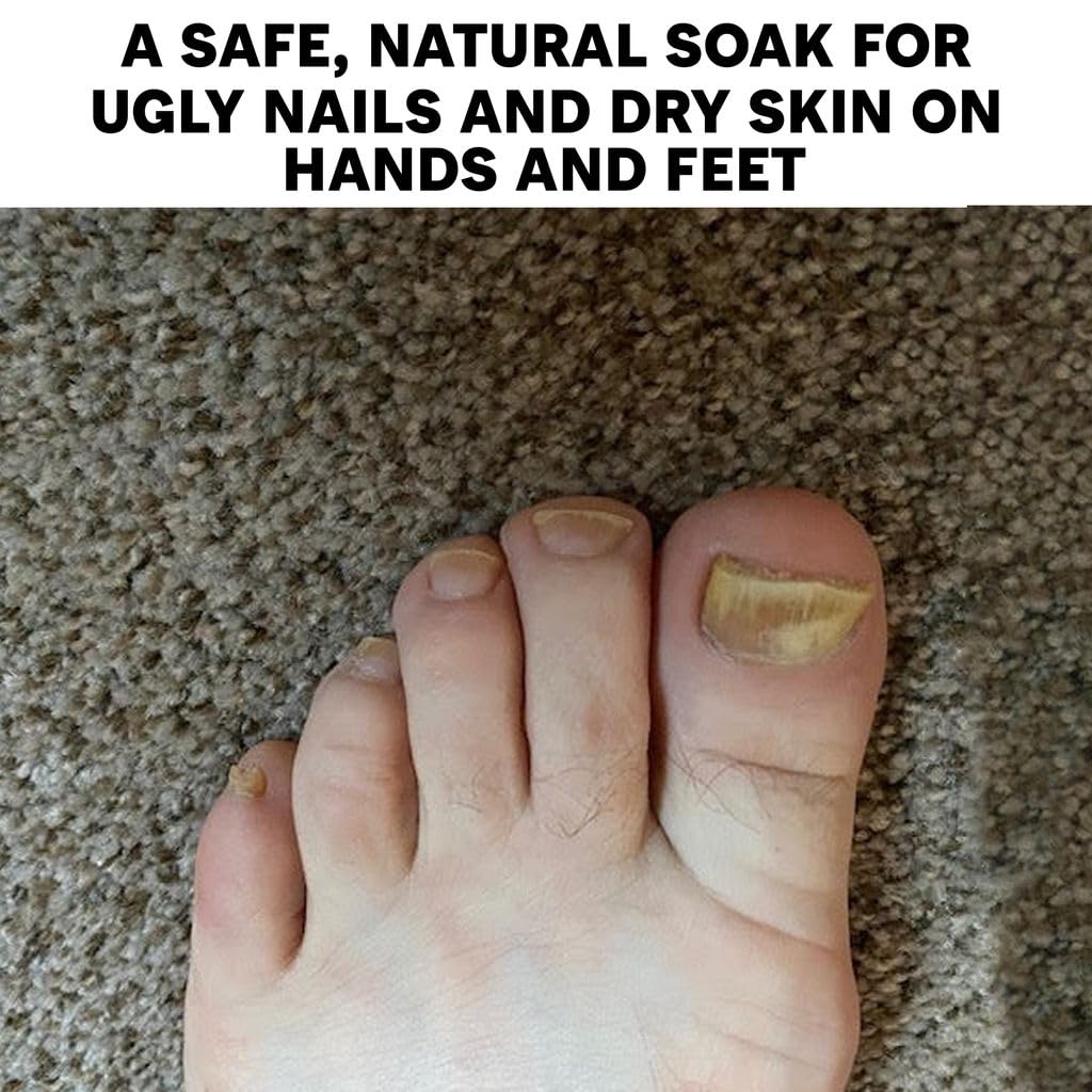 Long Creek Herbs Nail Soak targets cracked heels with regular use.