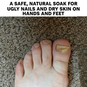 Long Creek Herbs Nail Soak targets cracked heels with regular use.
