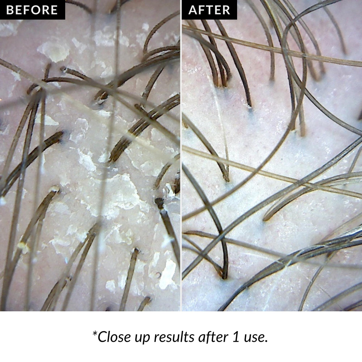 Love Ur Curls Exfoliating Scalp Scrub applicator for mess-free pre-shampoo treatment.