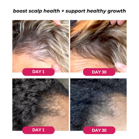 Love Ur Curls turmeric extracts: boosts density appearance.