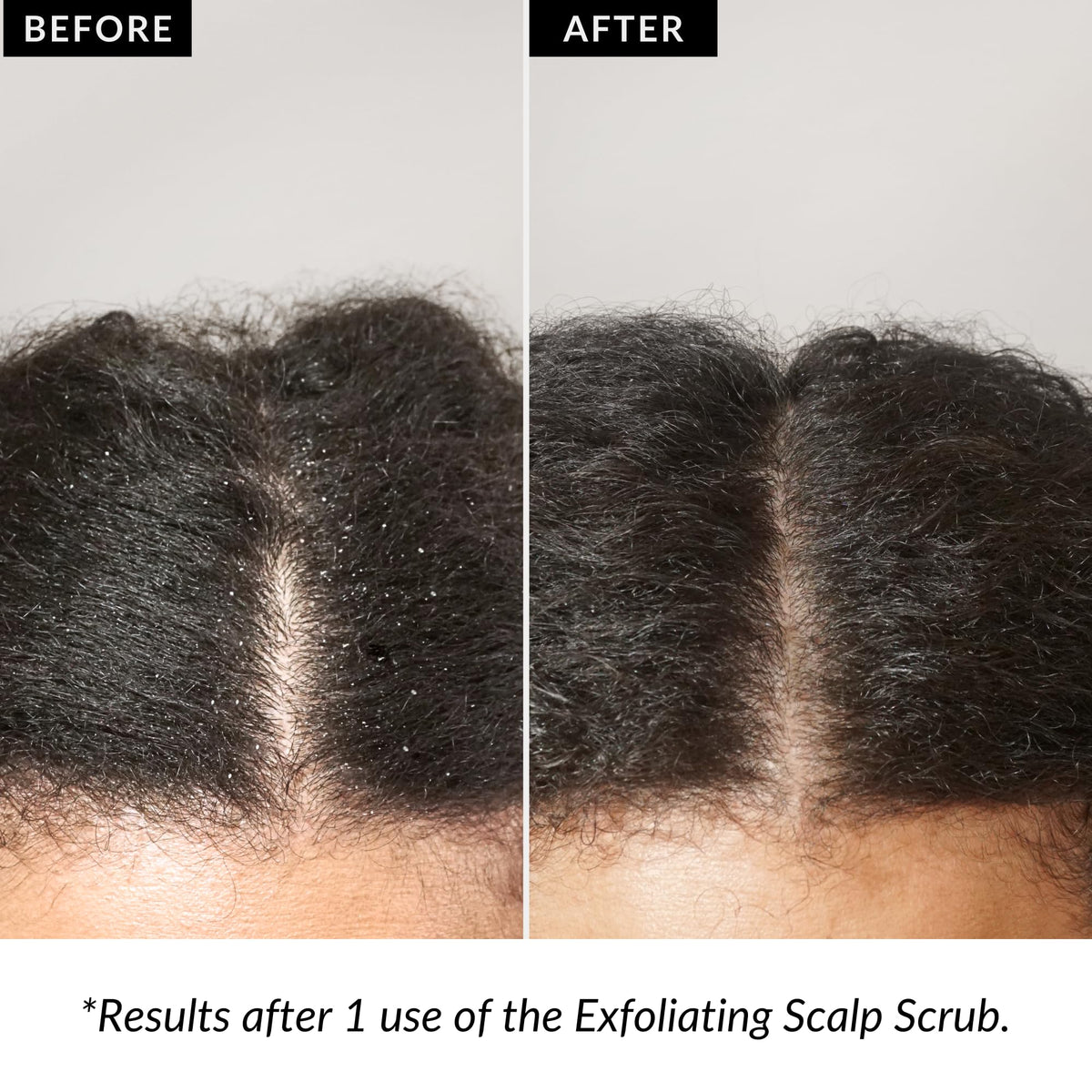 Love Ur Curls volcanic ash exfoliant smooths scalp surface.
