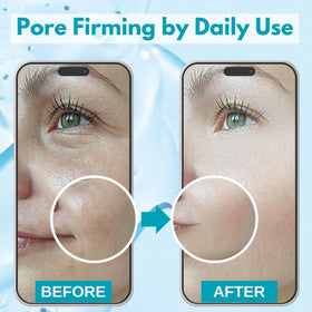 Lululun Bifida Ferment Filtrate ingredient close-up highlights deep hydration.