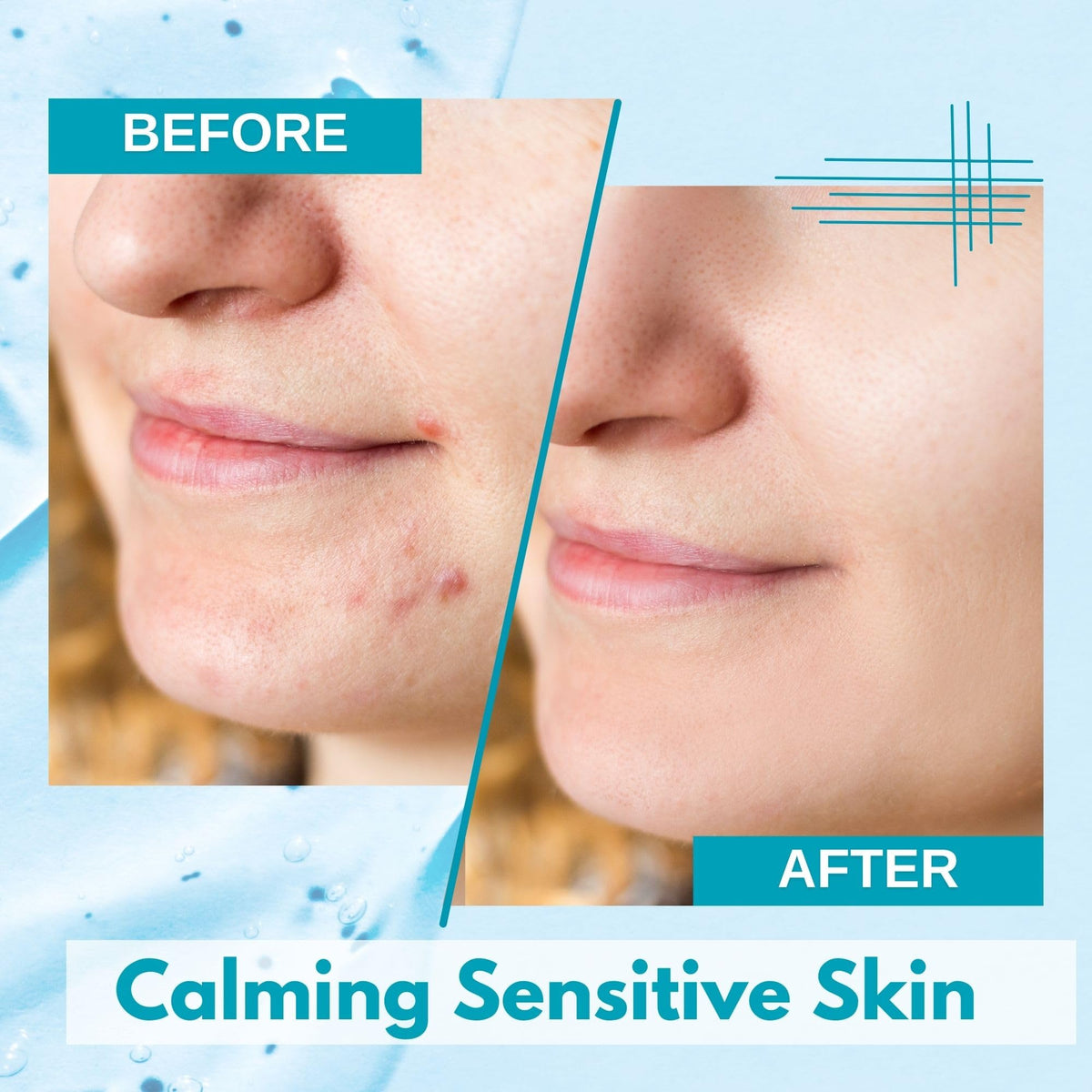 Lululun sheet mask on face delivers hydration boost for refreshed skin.