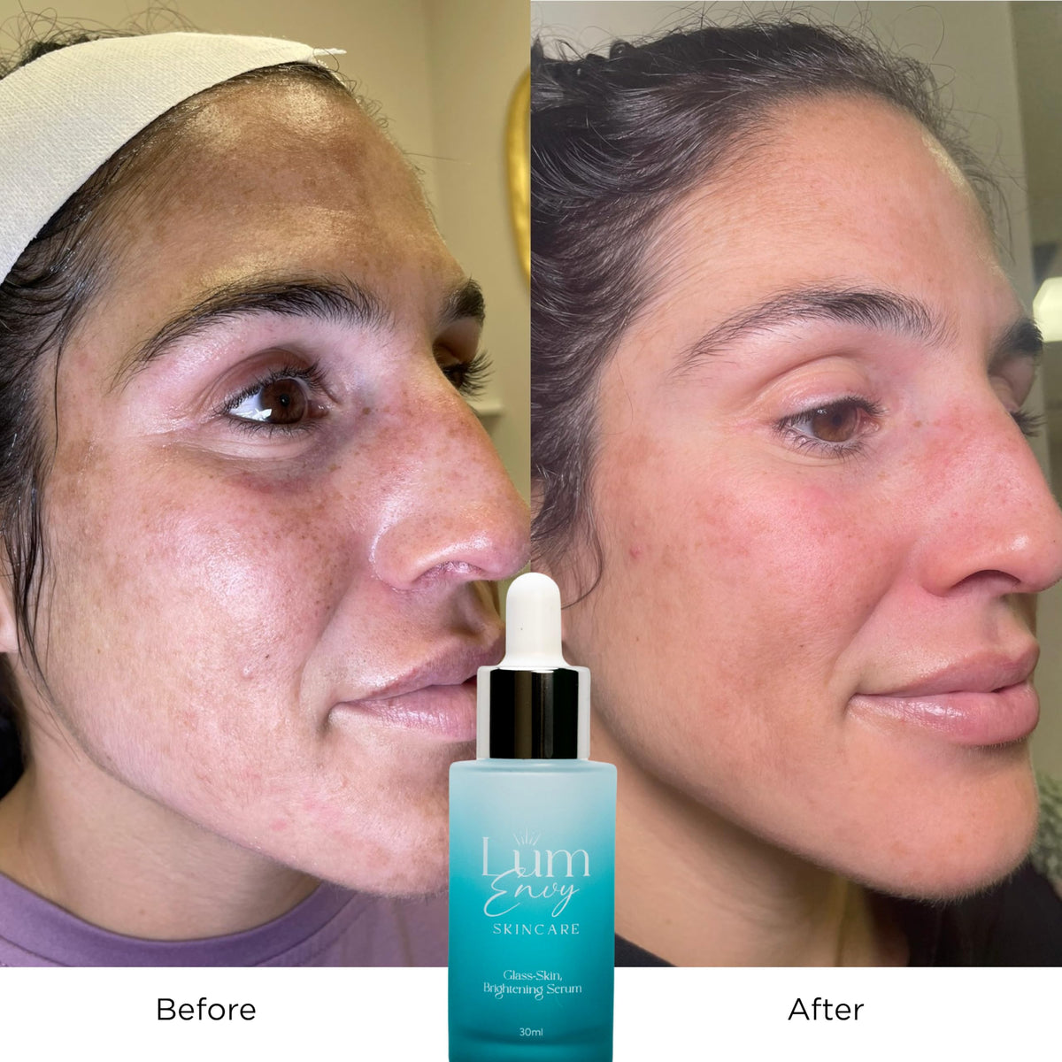 LumEnvy Centella Asiatica soothing elixir conveys gentle calming and antioxidant protection.