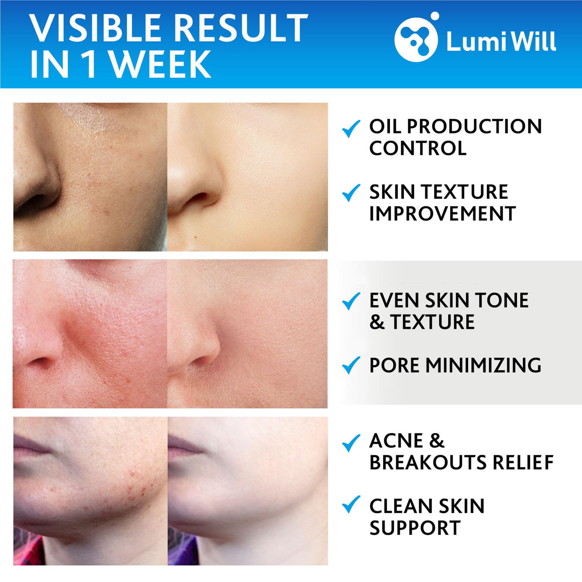 LUMI WILL Glycolic Pads green tea ingredients label highlighting soothing botanicals.