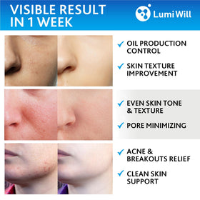 LUMI WILL Glycolic Pads green tea ingredients label highlighting soothing botanicals.