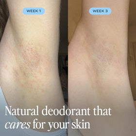 Luna Daily hyaluronic acid and prebiotics image suggests skin hydration support.