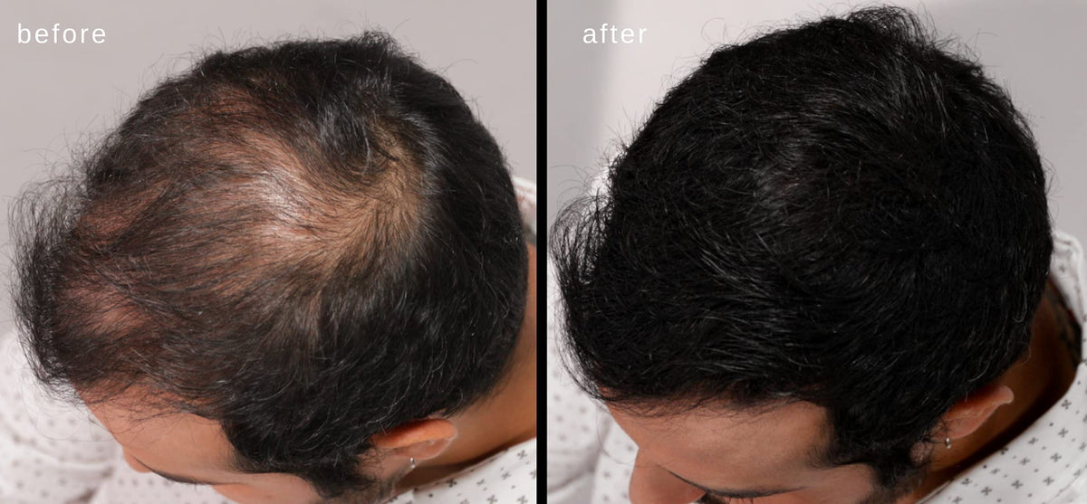 Blow drying remains possible without losing hair fiber hold.