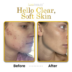 LUXEBEAUTY LuxeLotion sea buckthorn supports healthy-looking skin.