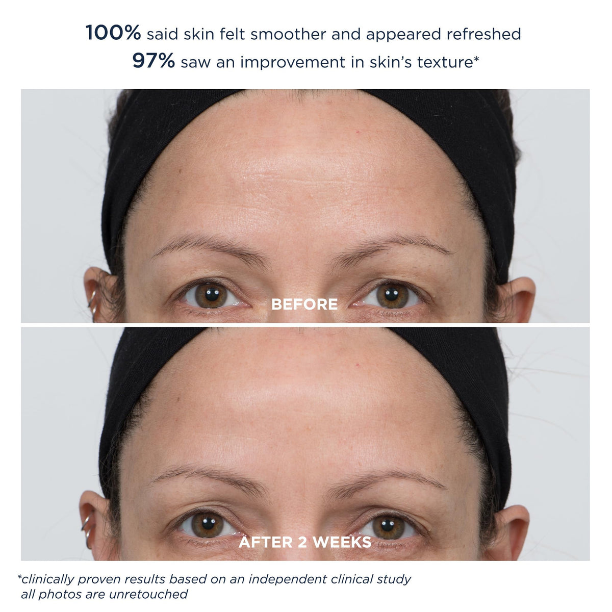 M-61 PowerGlow Peel clinical results badge references independent study outcomes.