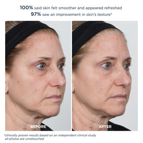 m-61 PowerGlow Peel night results suggest smoother skin by morning.