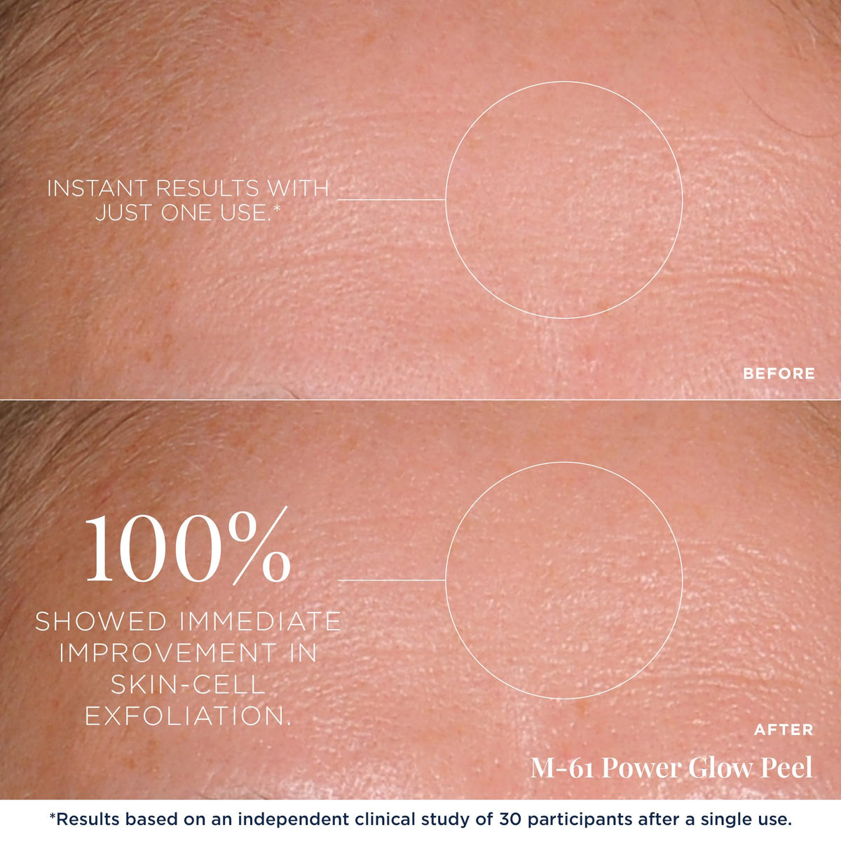 m-61 PowerGlow Peel pad close-up soaked with glycolic and salicylic acids.