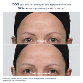 m-61 PowerGlow Peel pore size detail hints at refined pores.