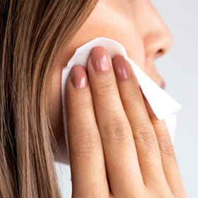 M-61 Powerspot Pads on blemish-prone skin demonstrating balance and redness reduction.