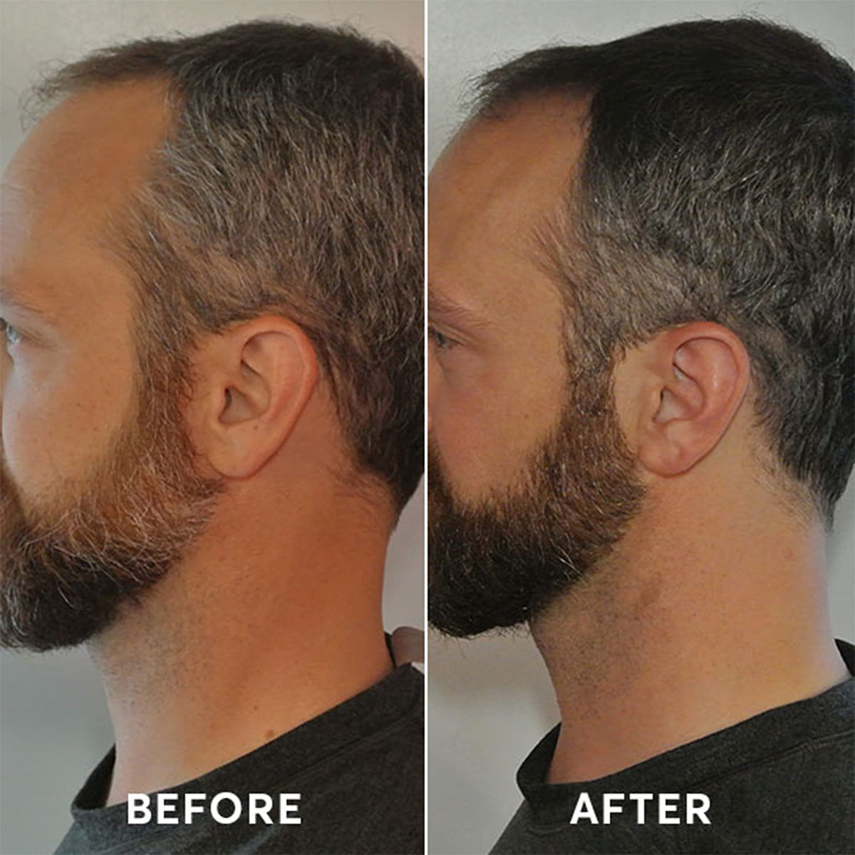Madison Reed Mr. Hair Color beard application close-up demonstrates natural blend.