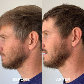 Madison Reed Mr Hair Color Men beard coloration option for blended look