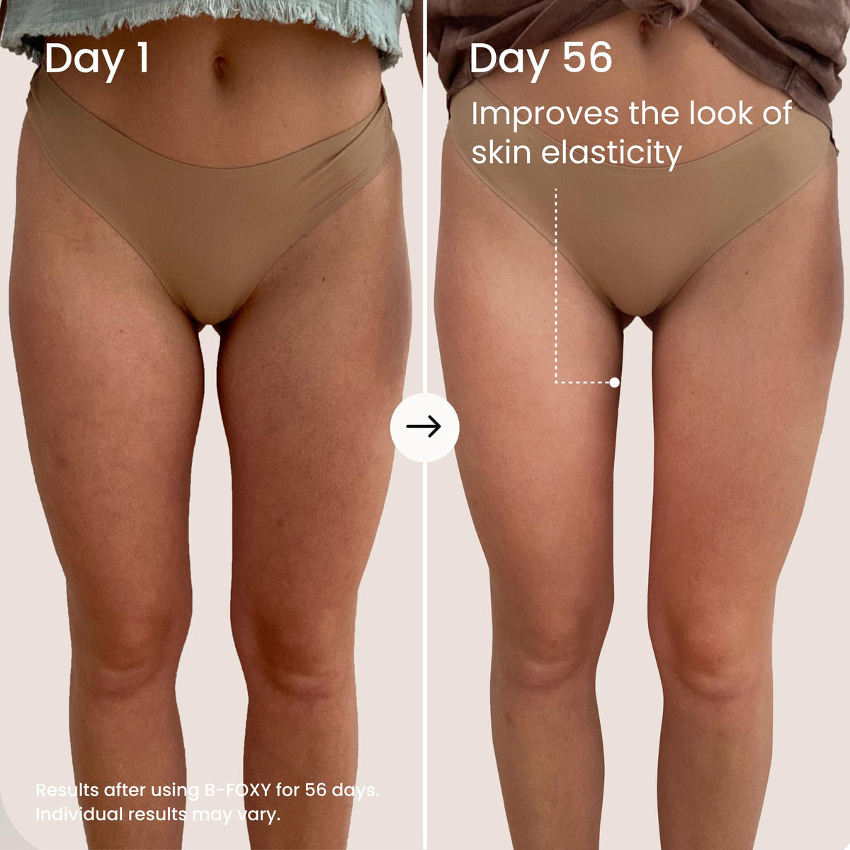 Applying MAËLYS B-FOXY inner thigh cream for comfort against chafing.