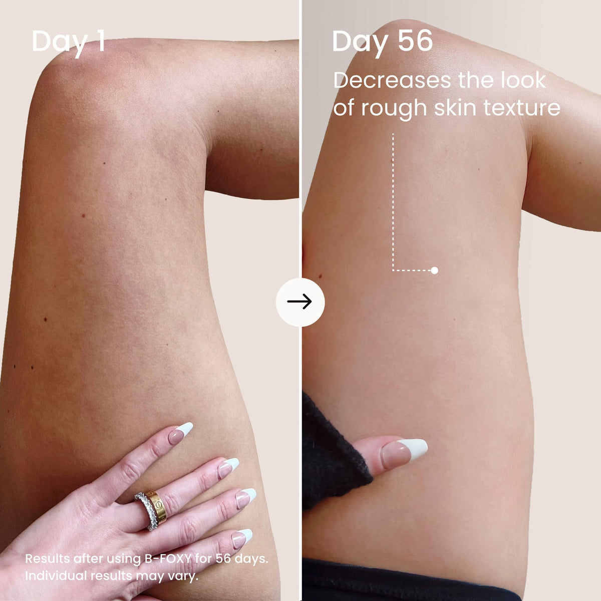 MAËLYS inner thigh cream smooths skin for a more even look.