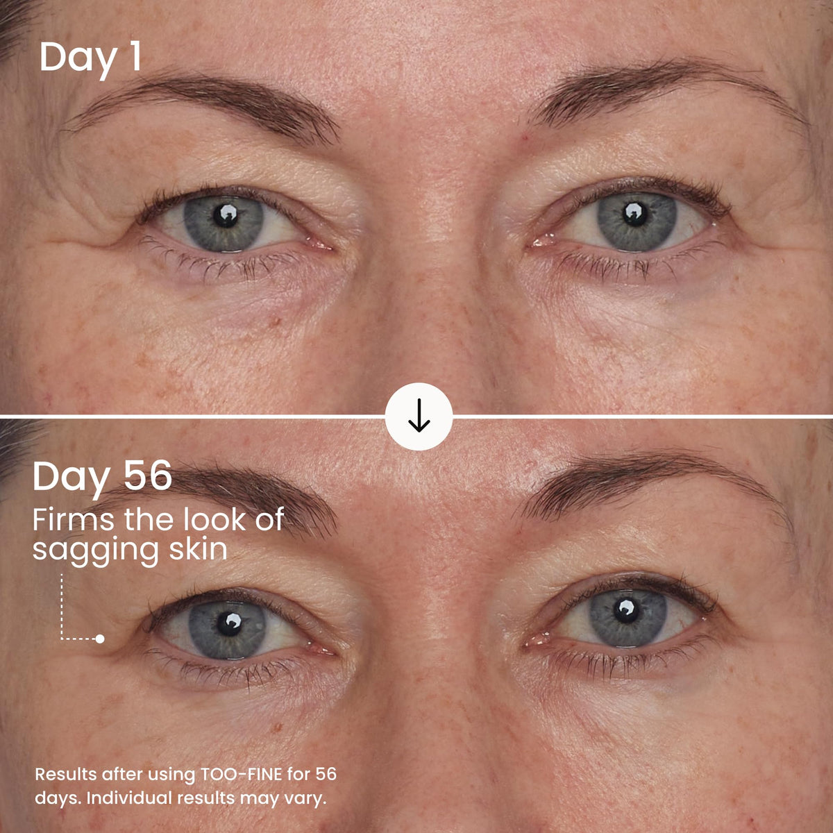 Maelys Too-Fine cheekbone-contour application enhances facial structure visually.