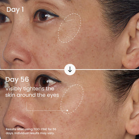 Maelys Too-Fine jawline-definition highlights precise formula for contour enhancement.