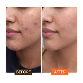 Makari Naturalle Carotonic Serum texture closeup shows lightweight oil blend.