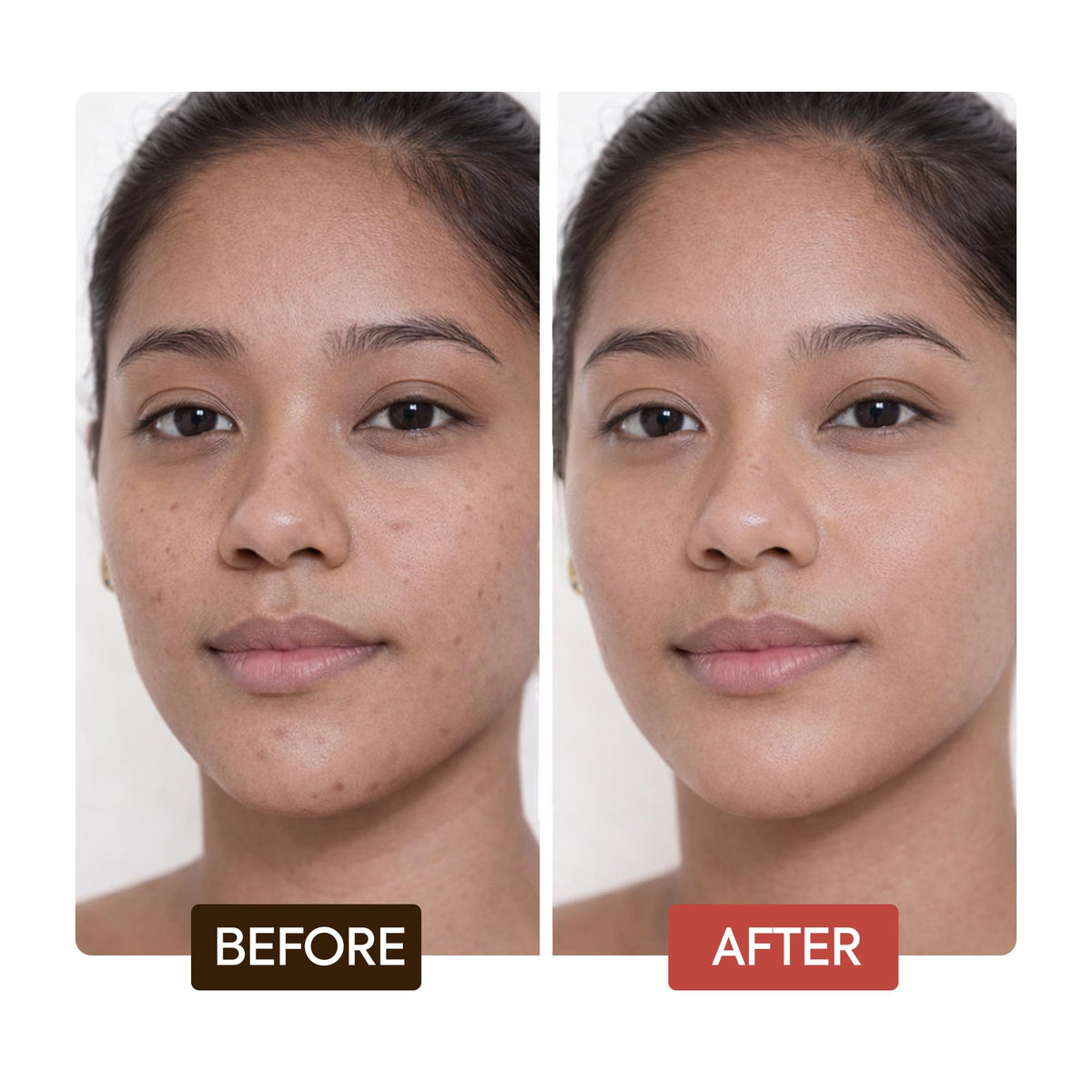 Makari Naturalle Intense Brightening Face Cream recommended for body spot treatment.