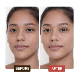 Makari Naturalle Intense Brightening Face Cream recommended for body spot treatment.
