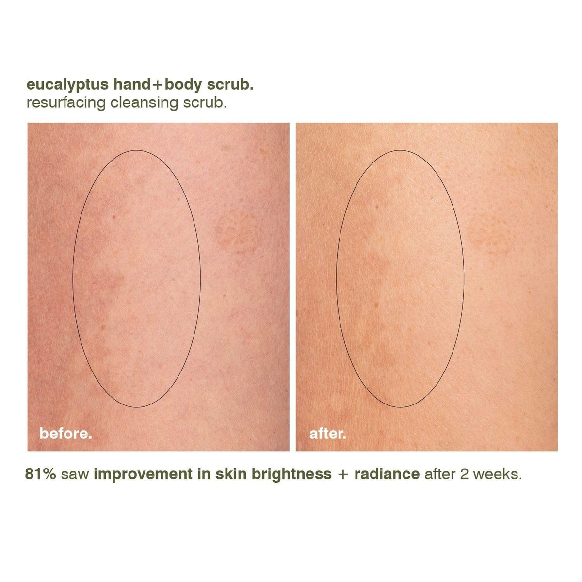 Bright, smooth skin with improved texture after use