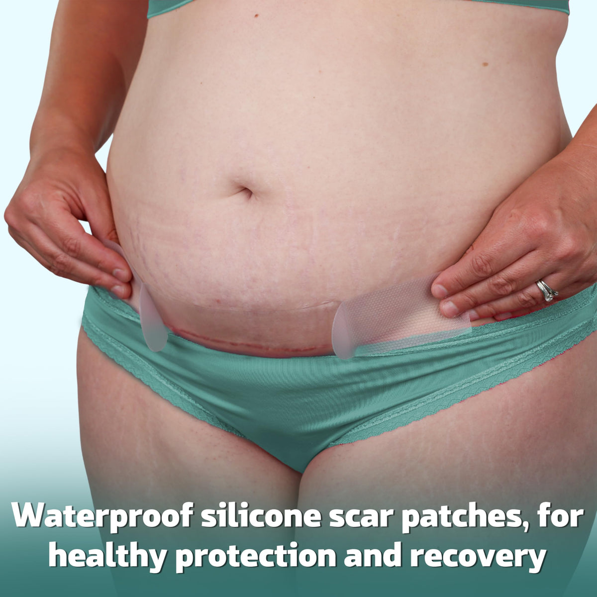 Mama & Wish C-Section Kit disposable underwear for quick changes and comfort.