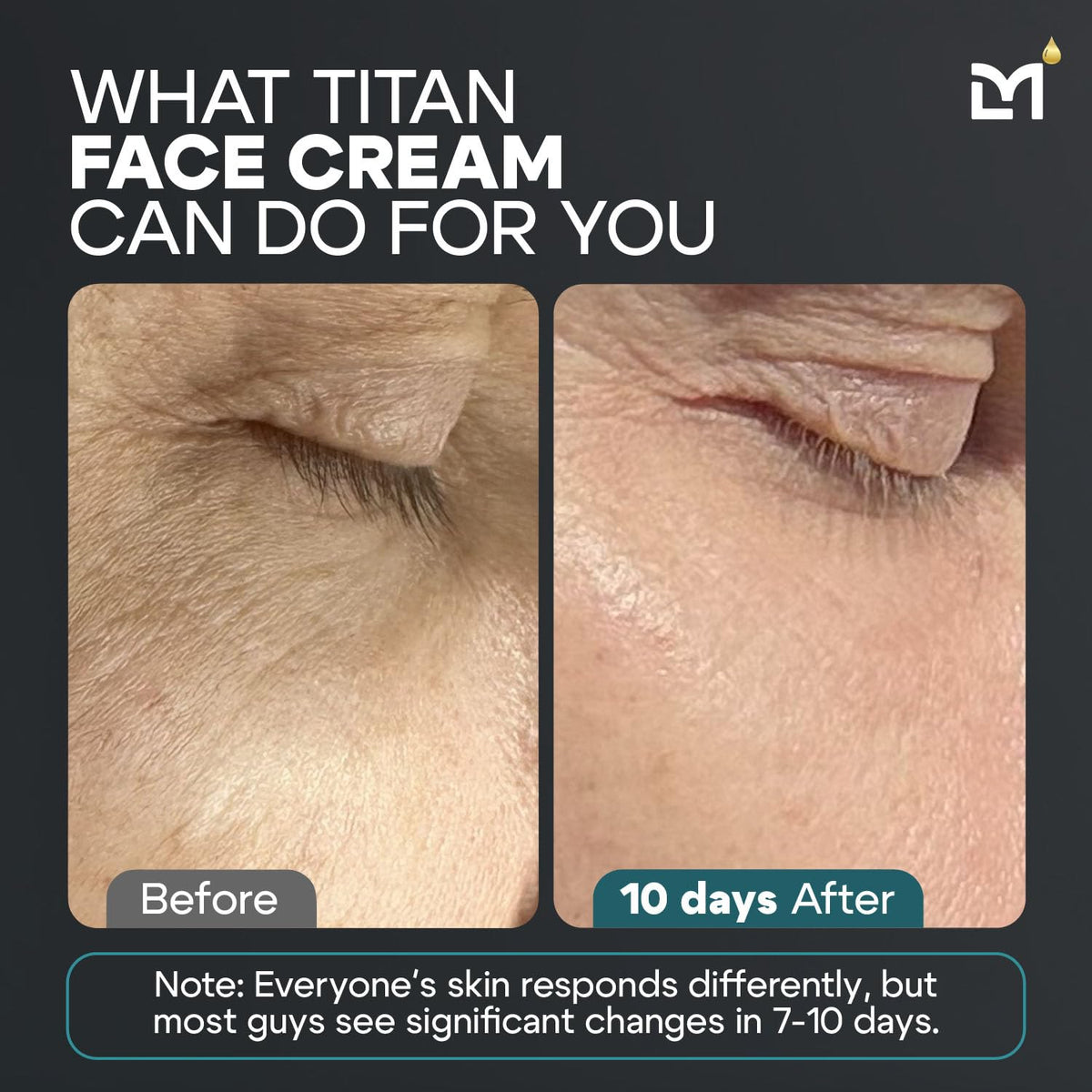 Man Labs Titan for men supports tightening and toning of skin.