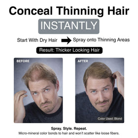 Mane hairline and bald-spot coverage blends with natural color for seamless look.