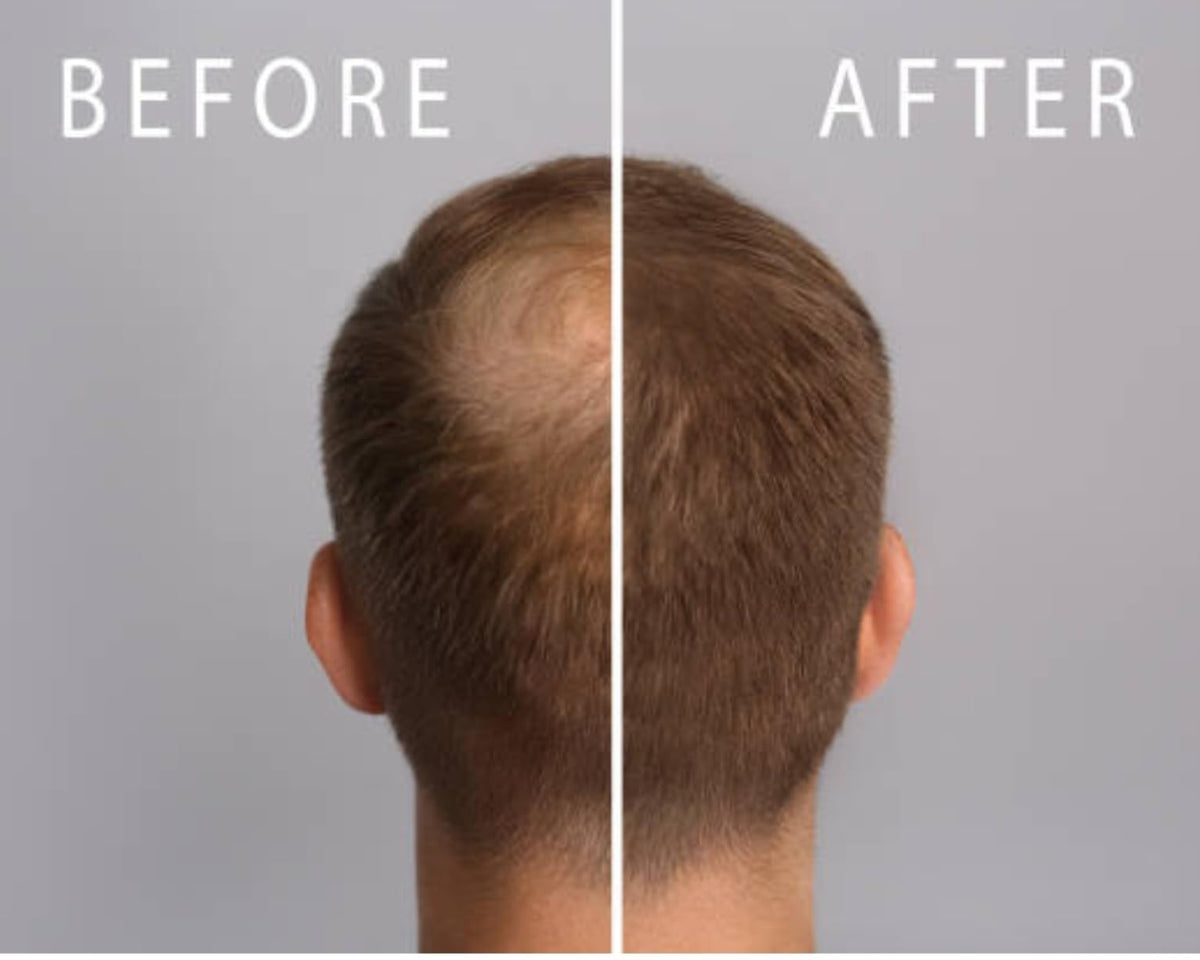 Scalp application of Mane Rain Hair Growth illustrating simple daily care steps.