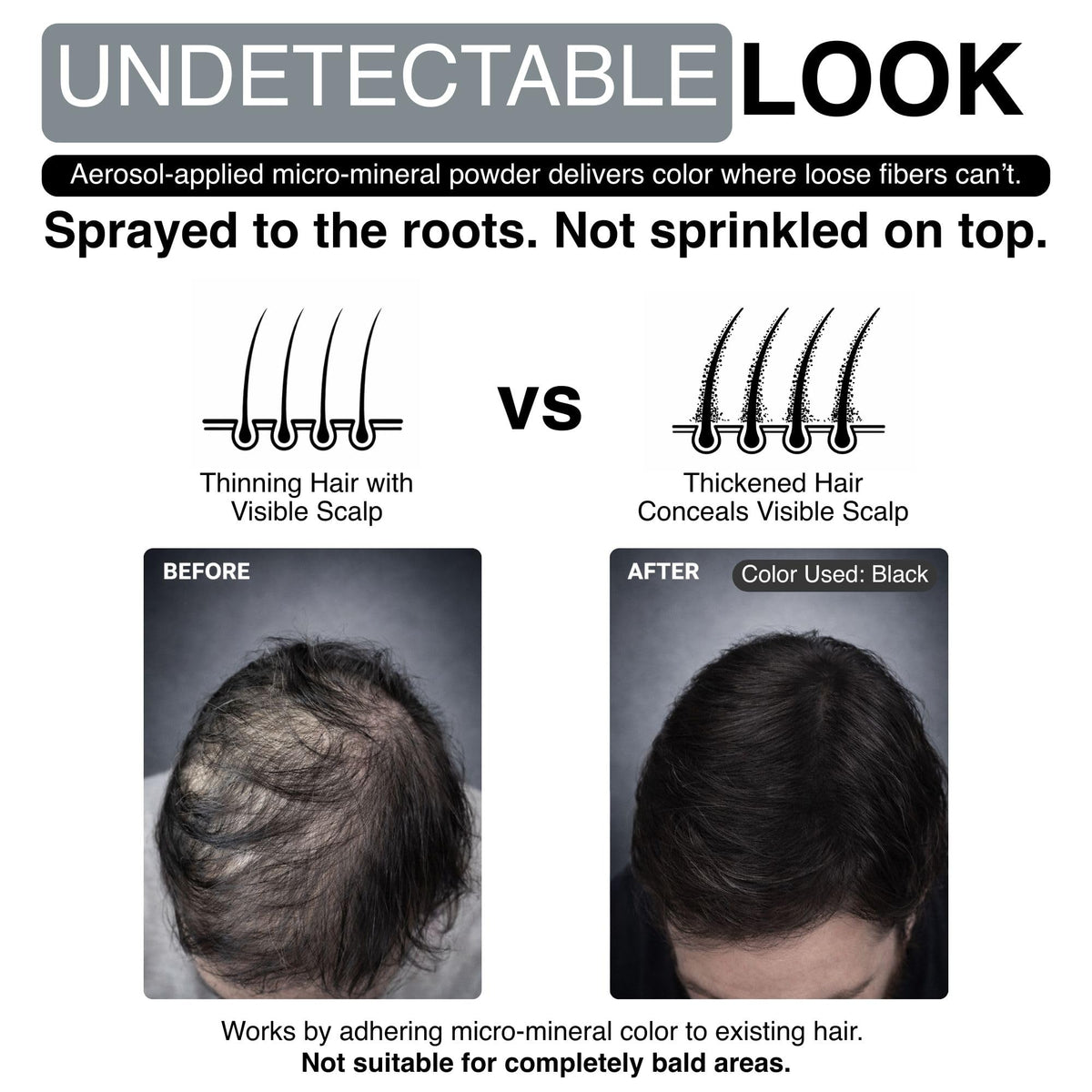 Mane thinning hair crown density shows visible fullness instantly.