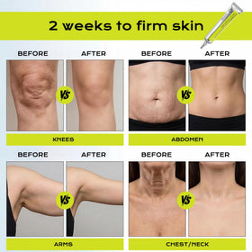 Manoai Botoxmix Shot application tube demonstrating targeted wrinkle care for laugh lines.