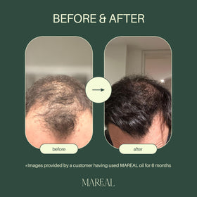 MAREAL Rosemary Oil dropper enabling precise scalp application.