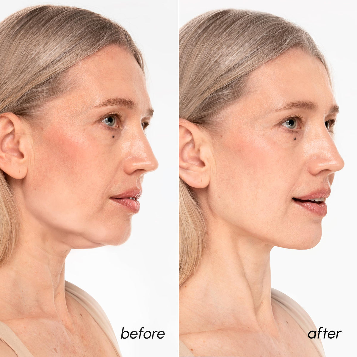 MAREE V Line Lifting Mask retinol hyaluronic acid boosts elasticity and smoothness