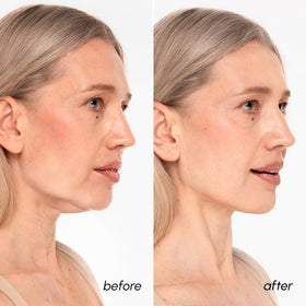 MAREE V Line Lifting Mask retinol hyaluronic acid boosts elasticity and smoothness