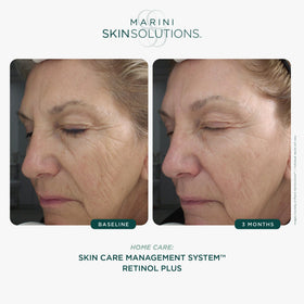 Marini SkinSolutions Retinol Plus texture close-up reveals a rich, hydrating cream.
