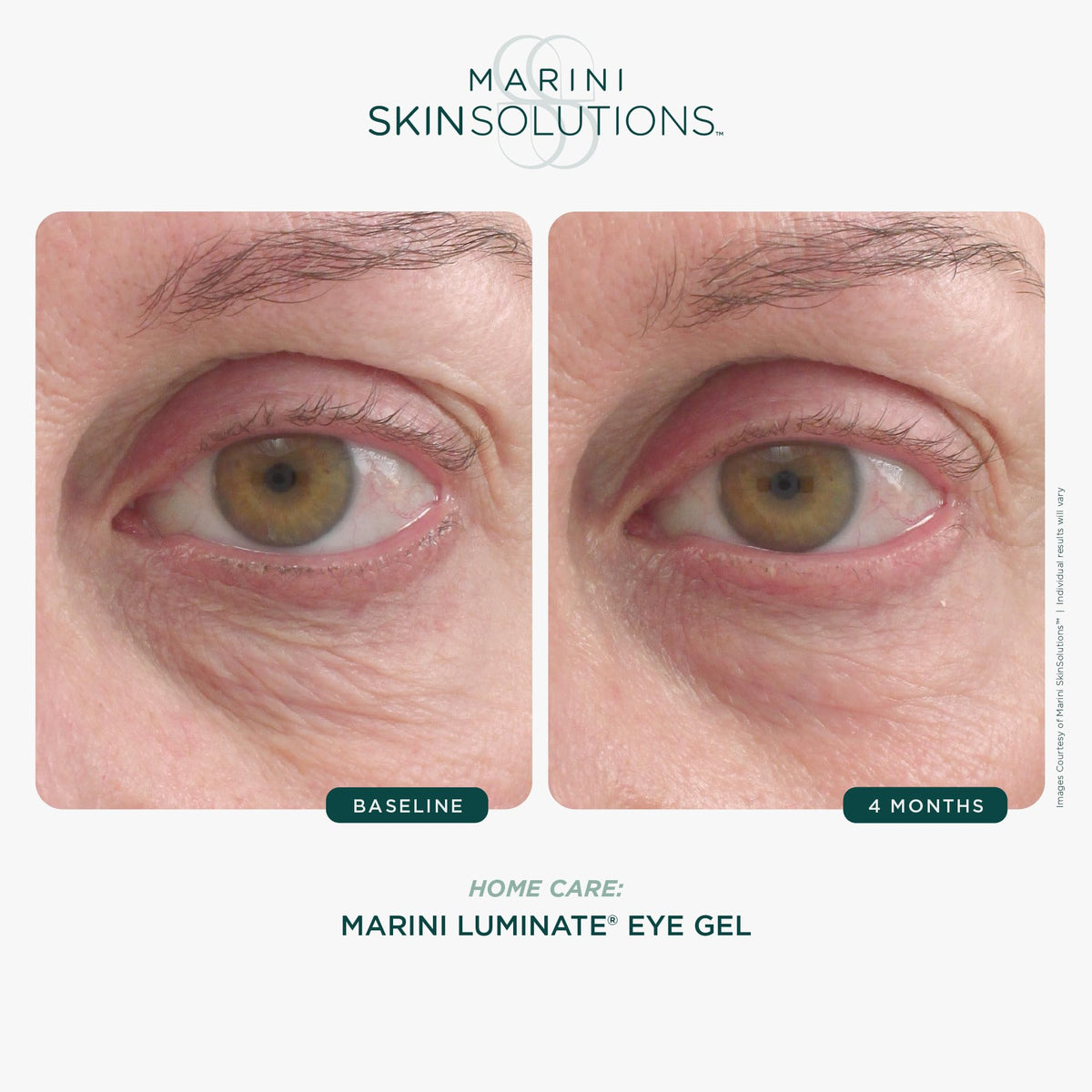 Marini SkinSolutions Luminate Eye Gel swirl texture close-up suggests brightening.