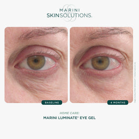 Marini SkinSolutions Luminate Eye Gel swirl texture close-up suggests brightening.