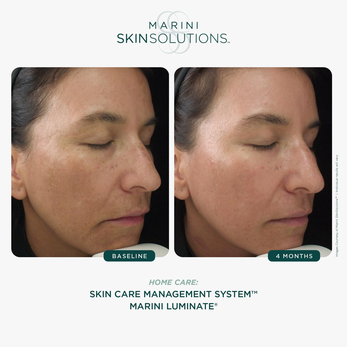 Marini SkinSolutions Luminate Face Lotion close-up on skin demonstrates gentle absorption.