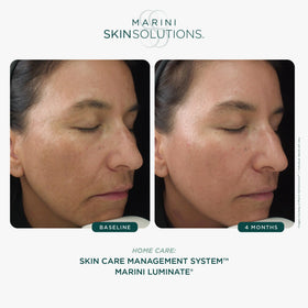 Marini SkinSolutions Luminate Face Lotion close-up on skin demonstrates gentle absorption.